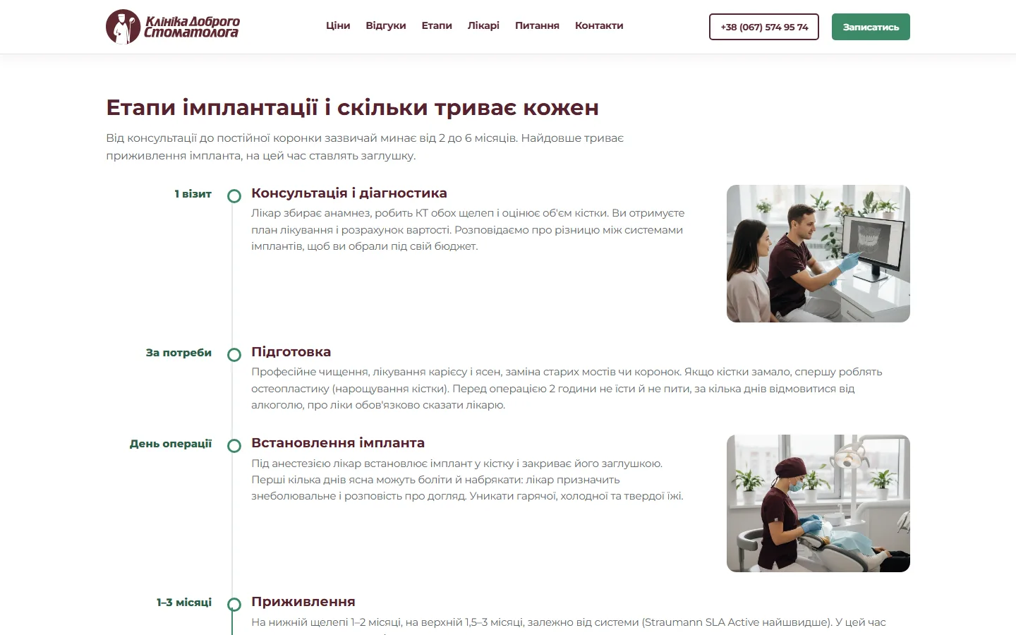 Етапи