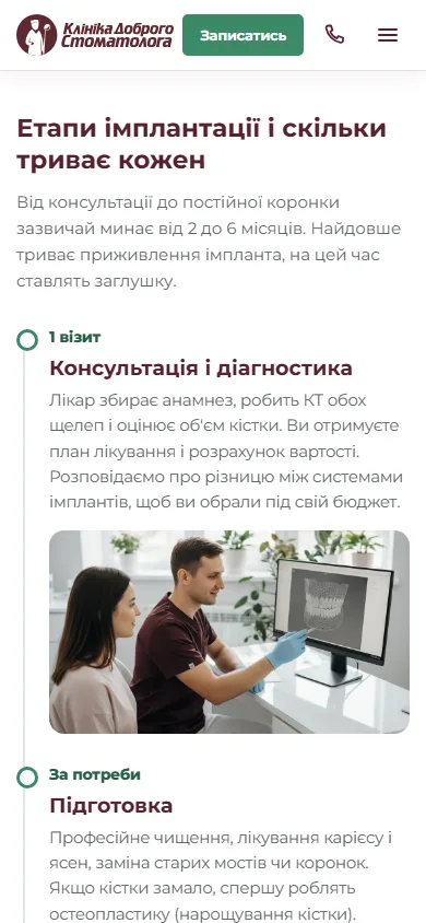 Етапи